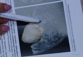 IMG_20240727_080258_481.webp IMG_20240727_080258_481.webp