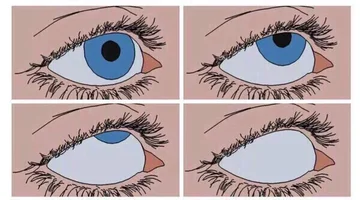 2624948426.webp 2624948426.webp